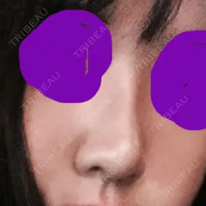 マーブル整形外科口コミ