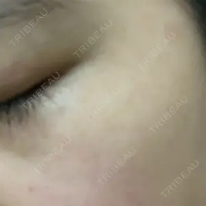 南青山TOKUNAKAクリニック口コミ