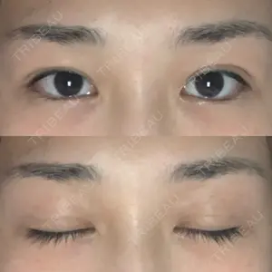 湘南美容クリニック 湘南美容クリニック 西宮北口院口コミ