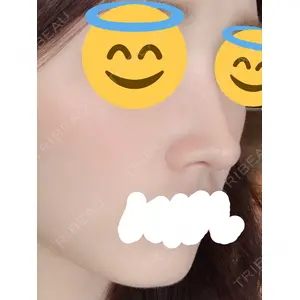 マーブル整形外科口コミ