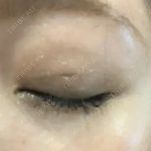 表参道スキンクリニック 表参道スキンクリニック 表参道院口コミ