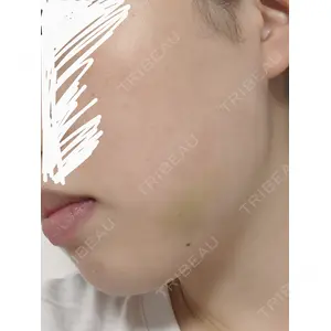 静岡美容外科橋本クリニックの口コミ