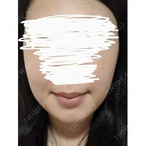 静岡美容外科橋本クリニックの口コミ