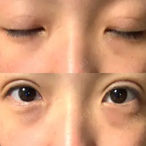 口コミ