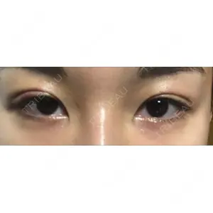 湘南美容クリニック 湘南美容クリニック 京都院口コミ