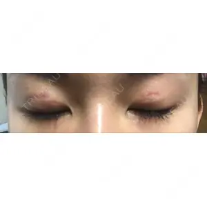 湘南美容クリニック 湘南美容クリニック 京都院口コミ