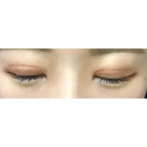 プロミス整形外科口コミ