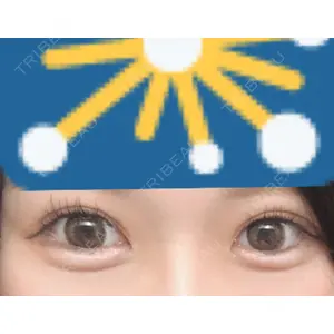 プロミス整形外科口コミ