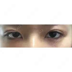 湘南美容クリニック 湘南美容クリニック 京都院口コミ