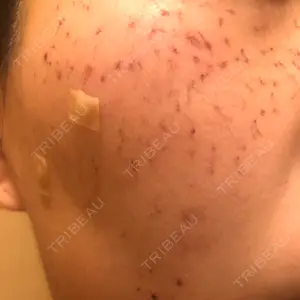 REYOUNGクリニック口コミ