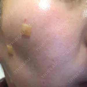 REYOUNGクリニック口コミ