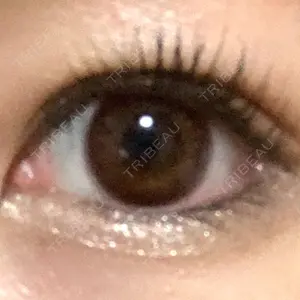 表参道スキンクリニック 表参道スキンクリニック 表参道院口コミ