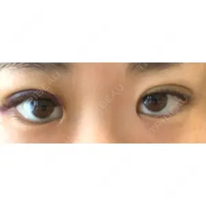 湘南美容クリニック 湘南美容クリニック 宇都宮院口コミ