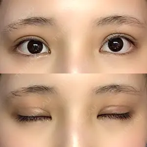 口コミ