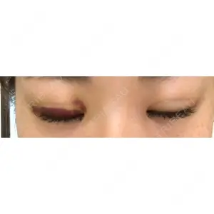 湘南美容クリニック 湘南美容クリニック 宇都宮院口コミ