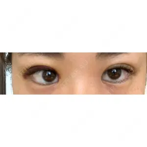 湘南美容クリニック 湘南美容クリニック 宇都宮院口コミ