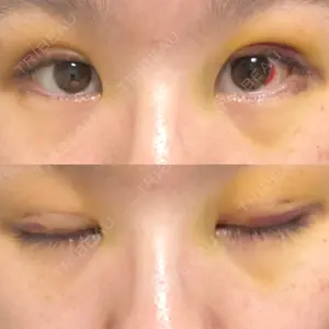 東京イセアクリニック口コミ
