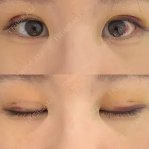 東京イセアクリニック口コミ
