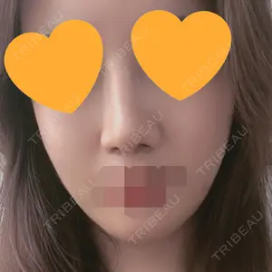 マーブル整形外科口コミ