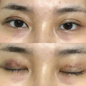 湘南美容クリニック 湘南美容クリニック 熊本院口コミ