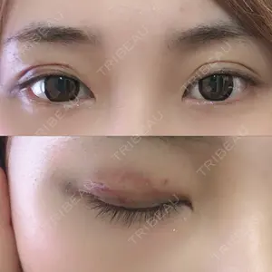 湘南美容クリニック 湘南美容クリニック 熊本院口コミ
