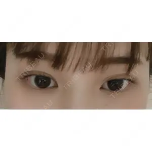 湘南美容クリニック 湘南美容クリニック 赤坂見附院口コミ