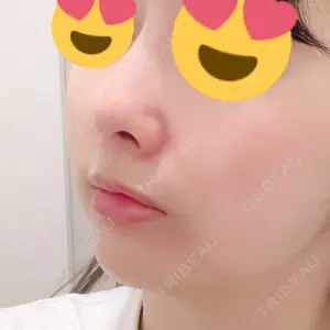 口コミ