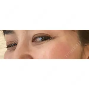 TCB東京中央美容外科 TCB東京中央美容外科 中野院口コミ