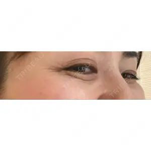 TCB東京中央美容外科 TCB東京中央美容外科 中野院口コミ