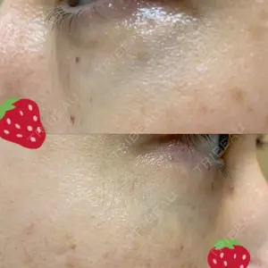 韓国ST美容整形外科口コミ