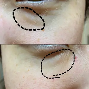 韓国ST美容整形外科口コミ