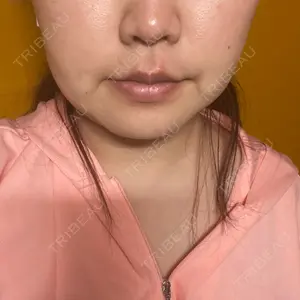 湘南美容クリニック 湘南美容クリニック 新宿本院口コミ