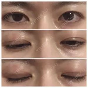 口コミ