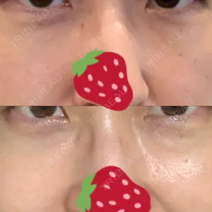 韓国ST美容整形外科口コミ