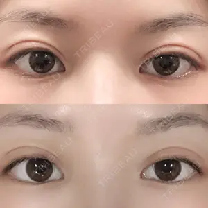 口コミ
