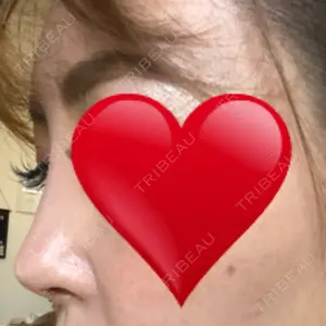 TCB東京中央美容外科 TCB東京中央美容外科 中野院口コミ