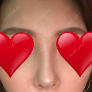 TCB東京中央美容外科 TCB東京中央美容外科 中野院口コミ
