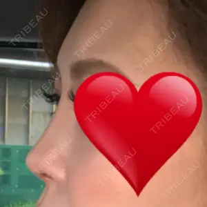 TCB東京中央美容外科 TCB東京中央美容外科 中野院口コミ