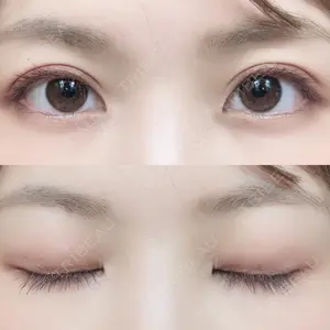 口コミ