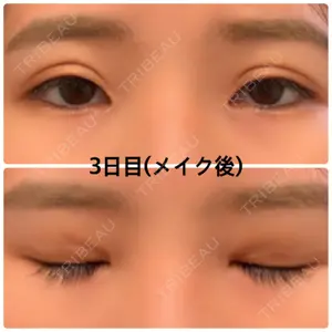 湘南美容クリニック 湘南美容クリニック 京都院口コミ