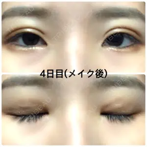 湘南美容クリニック 湘南美容クリニック 京都院口コミ