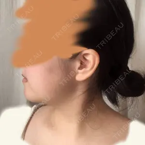 ボンディ美容整形外科（旧リオン整形外科）口コミ