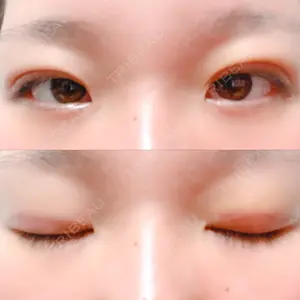 口コミ
