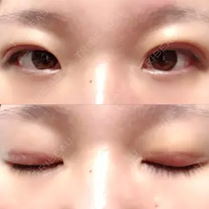 口コミ