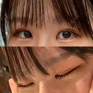 東京イセアクリニック口コミ