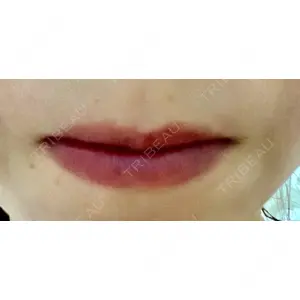 B-LINE CLINIC B-LINE CLINIC 池袋院口コミ