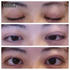 口コミ