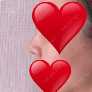 リッツ美容外科 大阪院口コミ