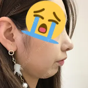 HANABI整形外科口コミ