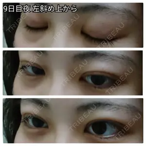 口コミ